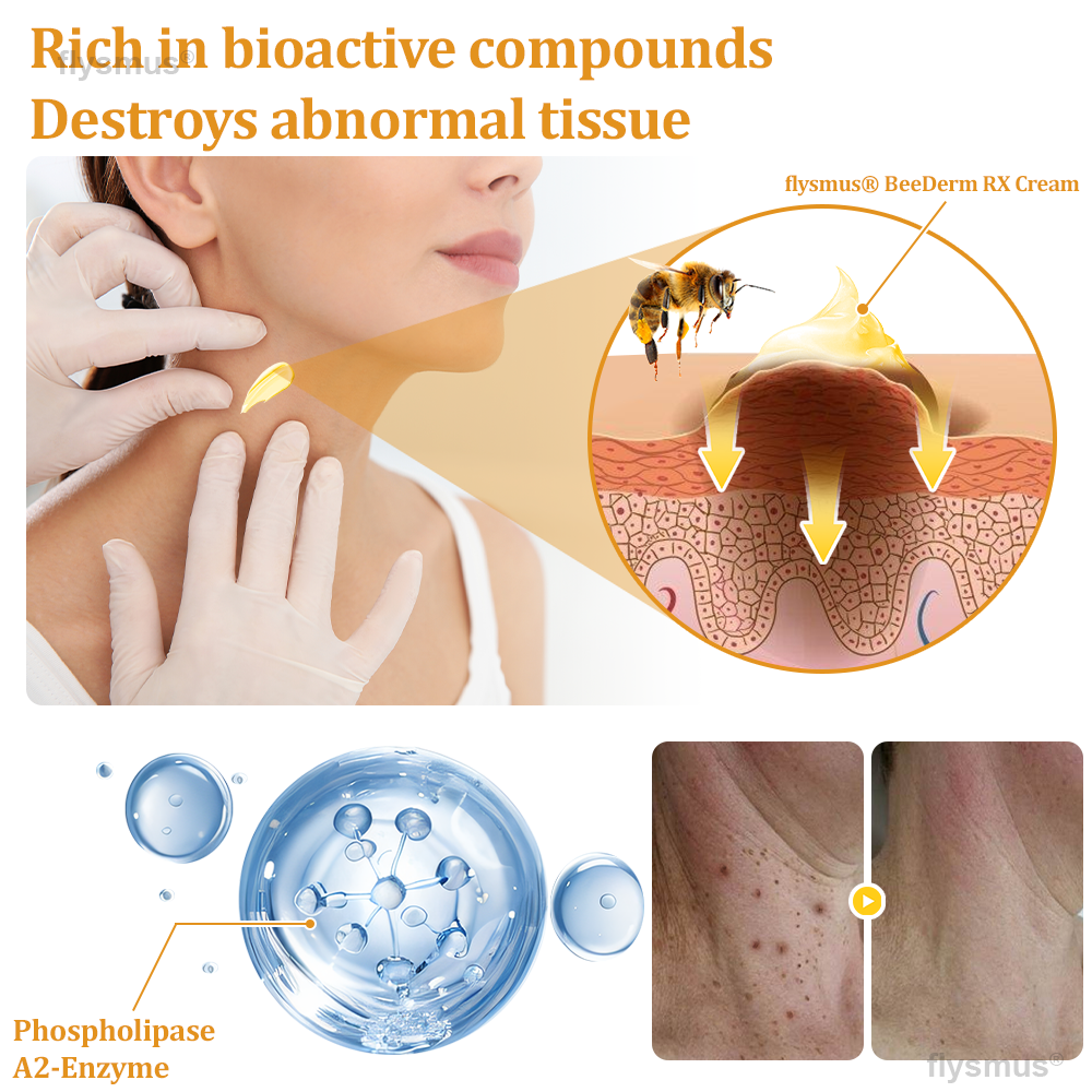 🎁flysmus® BeeDerm RX Cream, Painless, Targeted Treatment for Warts, Skin Tags, Skin Lesions, Infections, and Scars