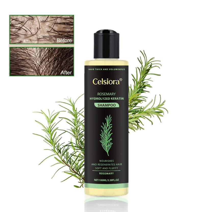 🔥LAST DAY 50% OFF👱♂️Celsiora® Organic Rosemary Hair Growth Shampoo
