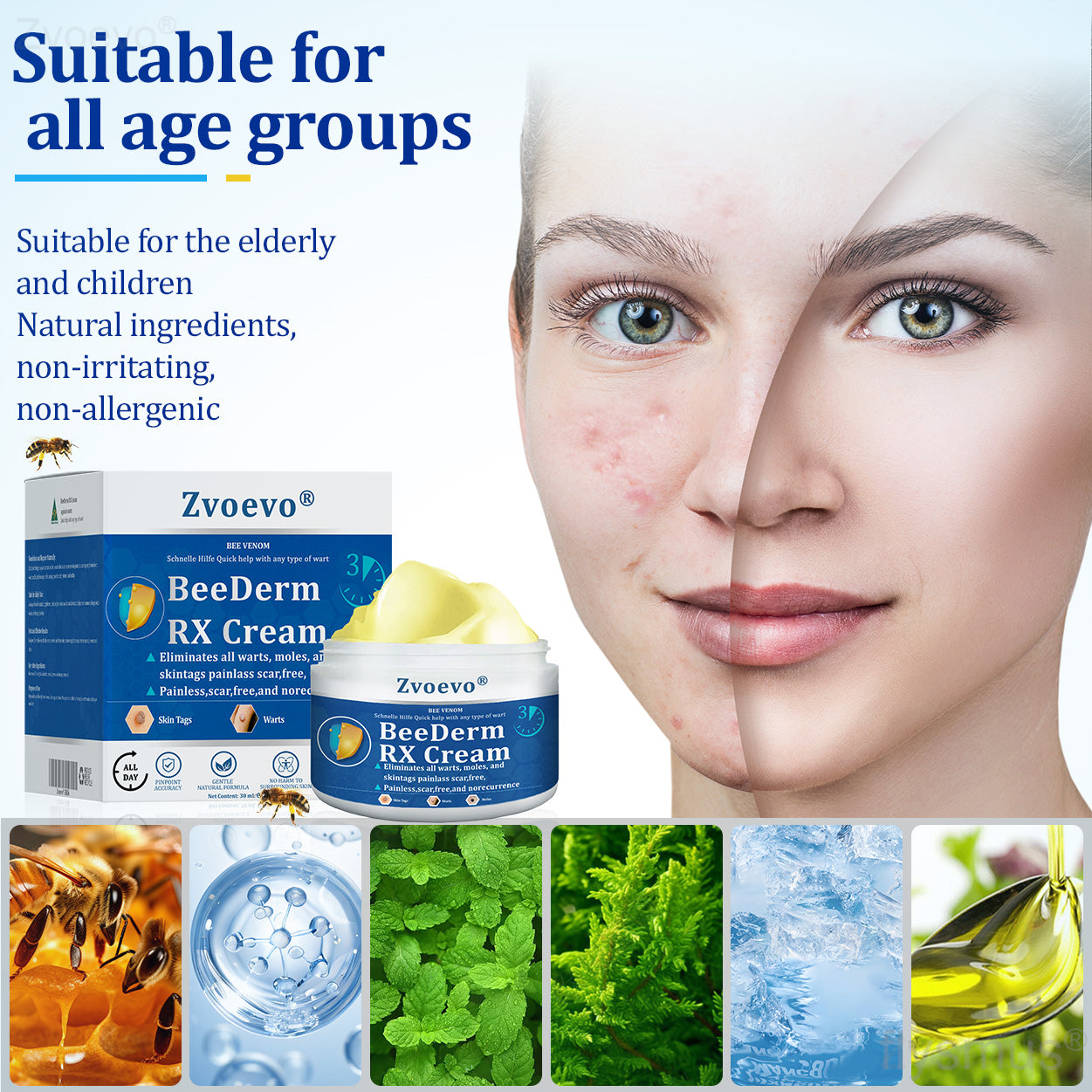 đŠââď¸ZvoevoÂŽ BeeDerm RX Cream, Painless, easy and gentle fix for warts, skin tags, lumps, infections, cysts and scars