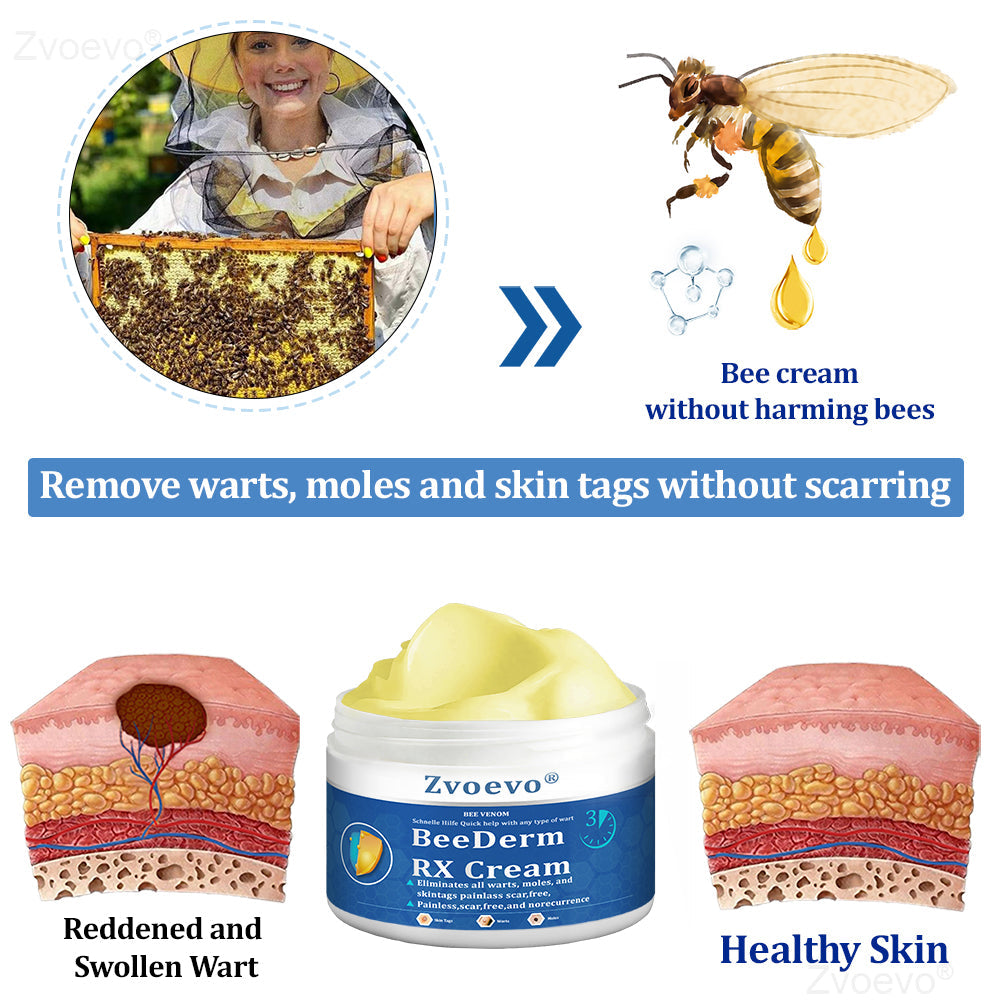 đŠââď¸ZvoevoÂŽ BeeDerm RX Cream, Painless, easy and gentle fix for warts, skin tags, lumps, infections, cysts and scars