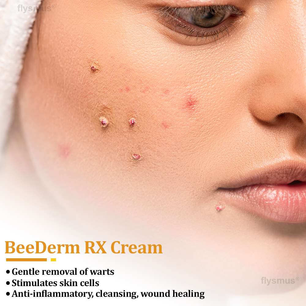 🎁flysmus® BeeDerm RX Cream, Painless, Targeted Treatment for Warts, Skin Tags, Skin Lesions, Infections, and Scars