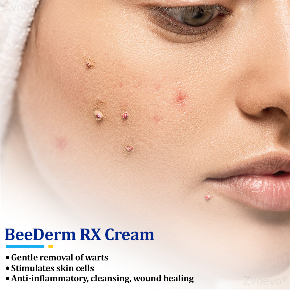 đŠââď¸ZvoevoÂŽ BeeDerm RX Cream, Painless, easy and gentle fix for warts, skin tags, lumps, infections, cysts and scars