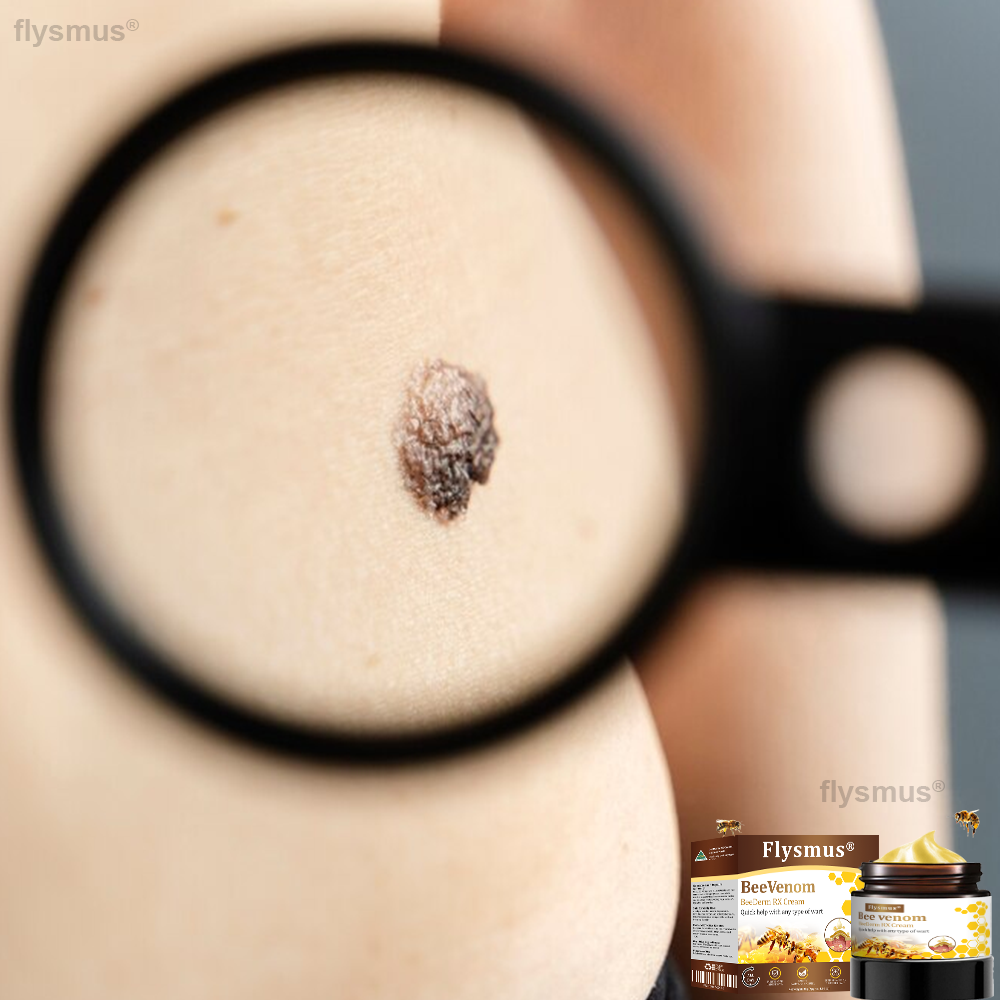 🎁flysmus® BeeDerm RX Cream, Painless, Targeted Treatment for Warts, Skin Tags, Skin Lesions, Infections, and Scars
