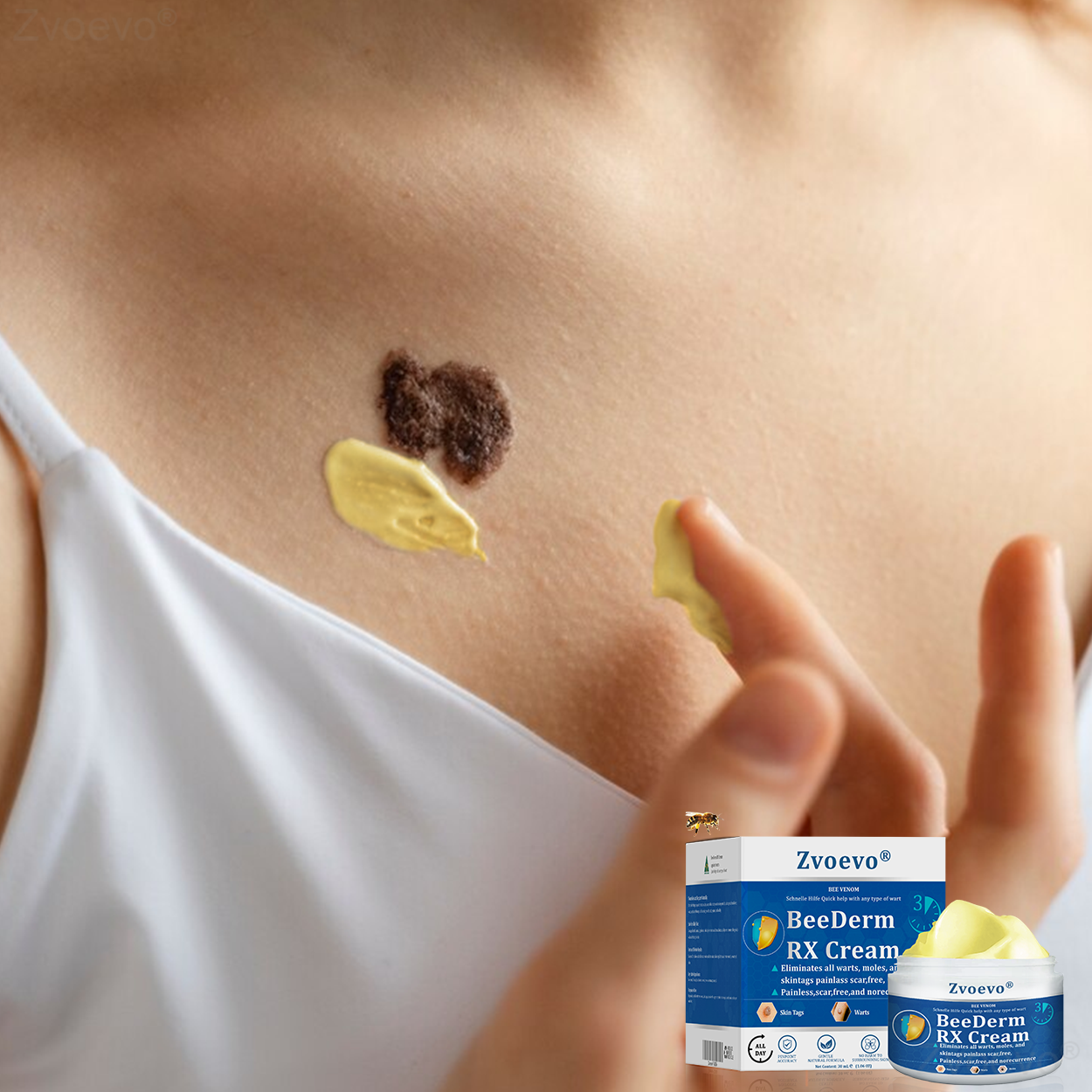 đŠââď¸ZvoevoÂŽ BeeDerm RX Cream, Painless, easy and gentle fix for warts, skin tags, lumps, infections, cysts and scars