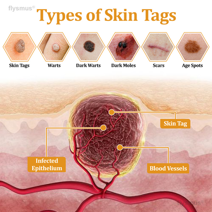 👍flysmus® BeeDerm RX Cream, Painless, Targeted Treatment for Warts, Skin Tags, Skin Lesions, Infections, and Scars