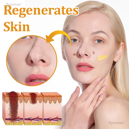 👍flysmus® BeeDerm RX Cream, Painless, Targeted Treatment for Warts, Skin Tags, Skin Lesions, Infections, and Scars