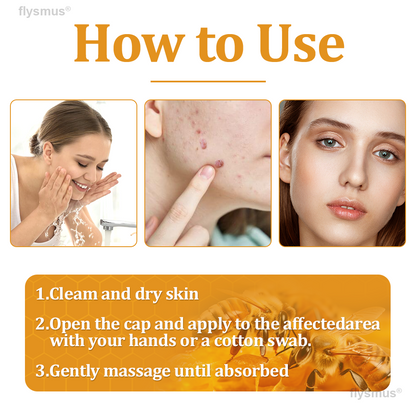 👍flysmus® BeeDerm RX Cream, Painless, Targeted Treatment for Warts, Skin Tags, Skin Lesions, Infections, and Scars