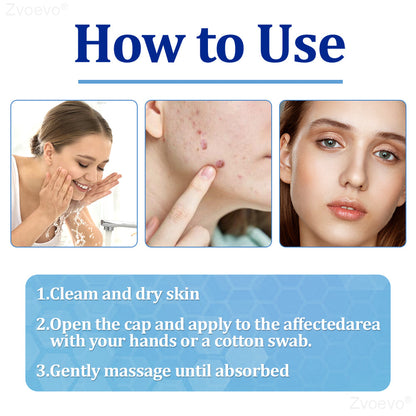 👩‍⚕️Zvoevo® BeeDerm RX Cream, Painless, easy and gentle fix for warts, skin tags, lumps, infections, cysts and scars