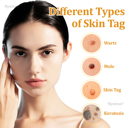 👍flysmus® BeeDerm RX Cream, Painless, Targeted Treatment for Warts, Skin Tags, Skin Lesions, Infections, and Scars