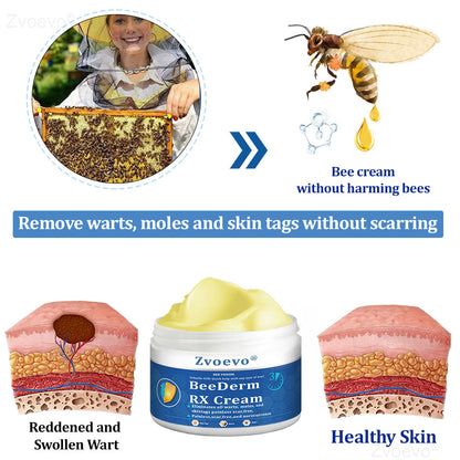 👩‍⚕️Zvoevo® BeeDerm RX Cream, Painless, easy and gentle fix for warts, skin tags, lumps, infections, cysts and scars