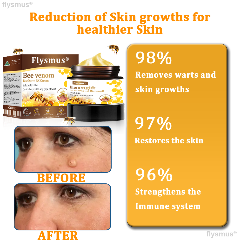 👍flysmus® BeeDerm RX Cream, Painless, Targeted Treatment for Warts, Skin Tags, Skin Lesions, Infections, and Scars