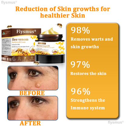👍flysmus® BeeDerm RX Cream, Painless, Targeted Treatment for Warts, Skin Tags, Skin Lesions, Infections, and Scars