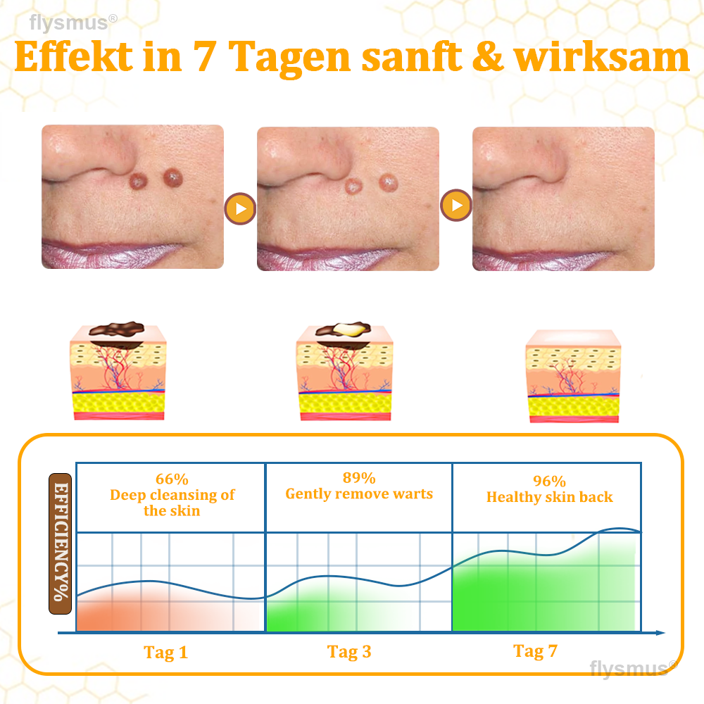 👍flysmus® BeeDerm RX Cream, Painless, Targeted Treatment for Warts, Skin Tags, Skin Lesions, Infections, and Scars