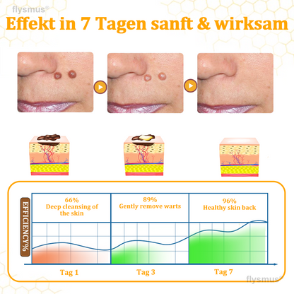 👍flysmus® BeeDerm RX Cream, Painless, Targeted Treatment for Warts, Skin Tags, Skin Lesions, Infections, and Scars