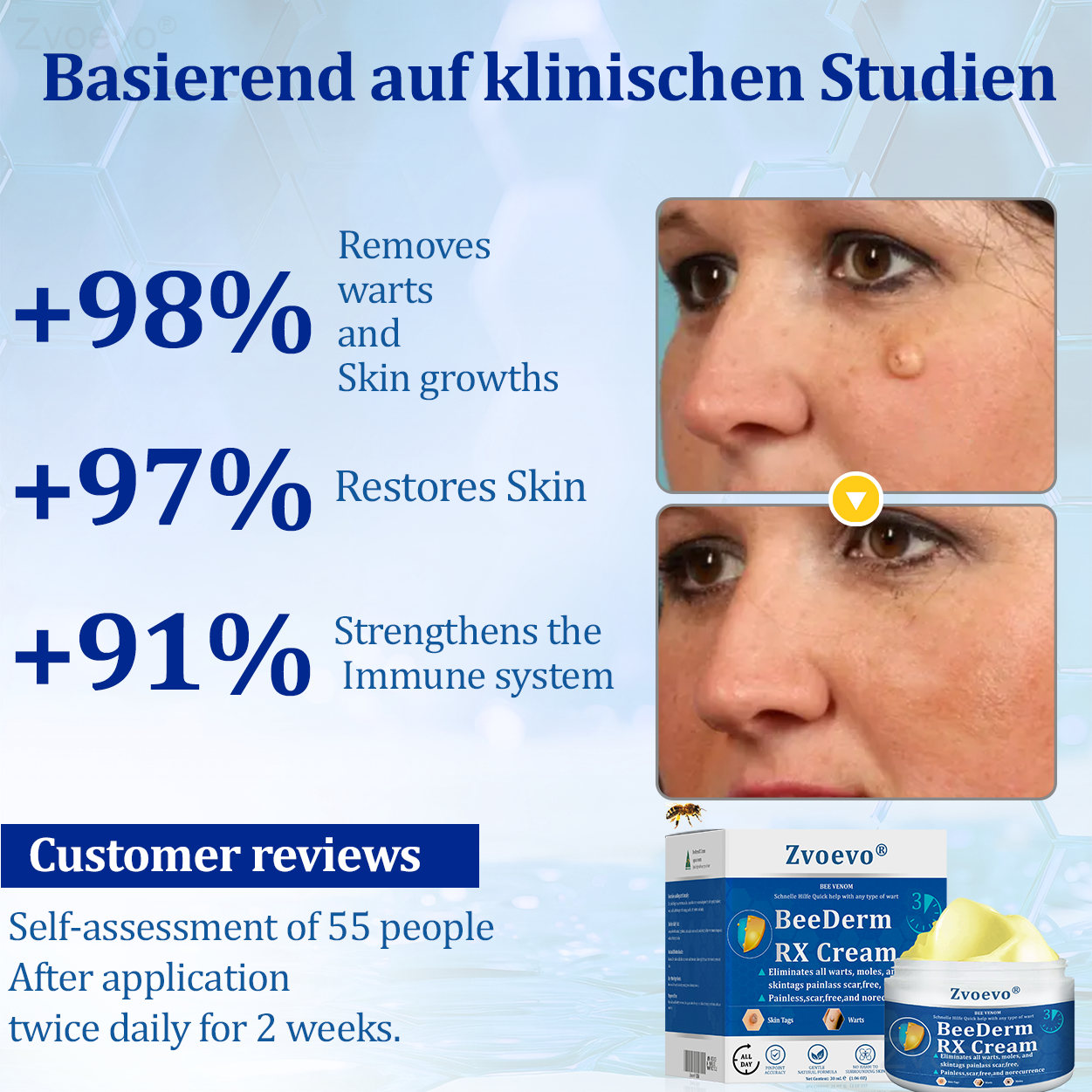 👩‍⚕️Zvoevo® BeeDerm RX Cream, Painless, easy and gentle fix for warts, skin tags, lumps, infections, cysts and scars