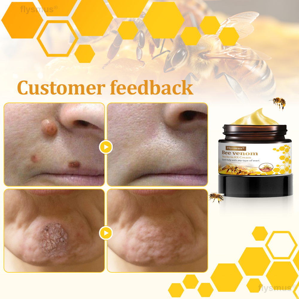 👍flysmus® BeeDerm RX Cream, Painless, Targeted Treatment for Warts, Skin Tags, Skin Lesions, Infections, and Scars