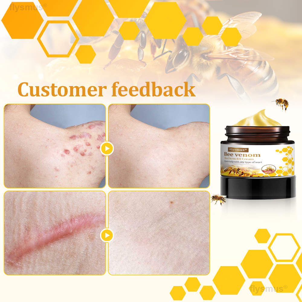👍flysmus® BeeDerm RX Cream, Painless, Targeted Treatment for Warts, Skin Tags, Skin Lesions, Infections, and Scars