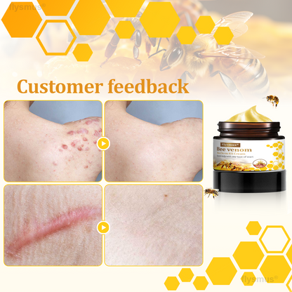 👍flysmus® BeeDerm RX Cream, Painless, Targeted Treatment for Warts, Skin Tags, Skin Lesions, Infections, and Scars