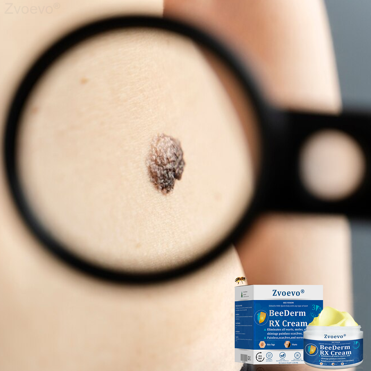 👩‍⚕️Zvoevo® BeeDerm RX Cream, Painless, easy and gentle fix for warts, skin tags, lumps, infections, cysts and scars